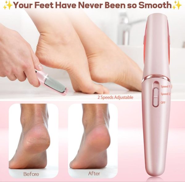 fine callus remover